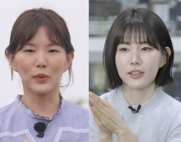 ヒョンスクのフィラー・ボトックス体験から考える肌ケア